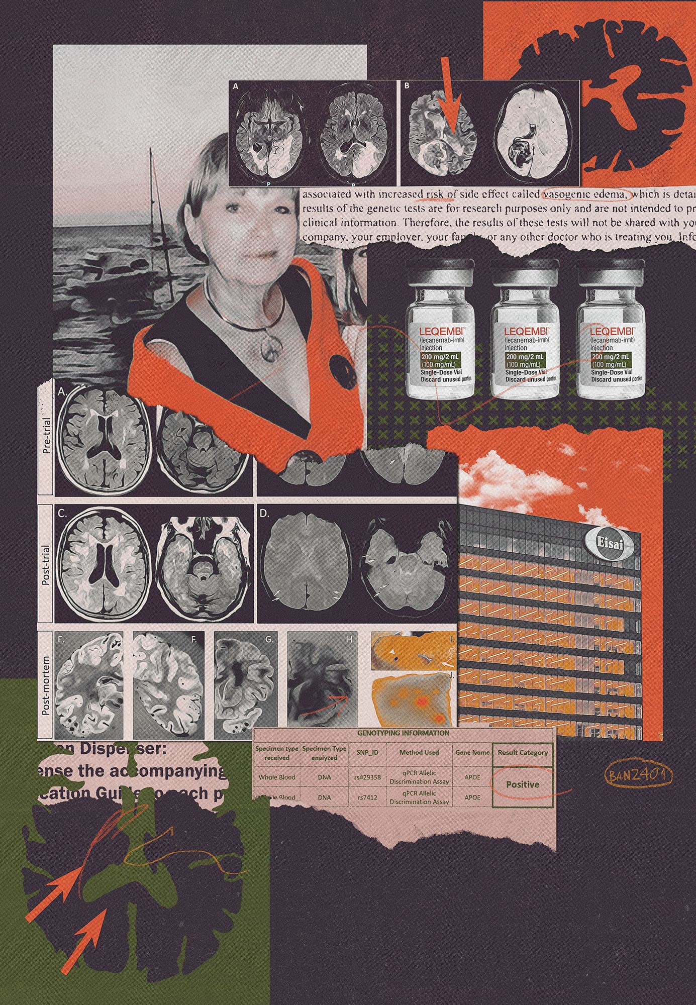 New York Times: Alzheimer's drug dangers